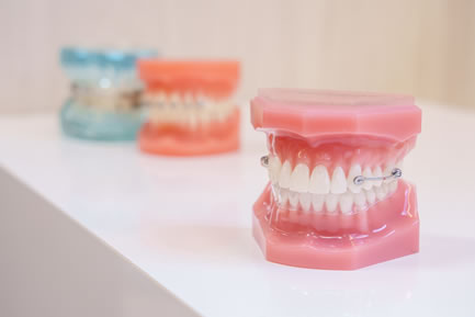 画像：歯の模型