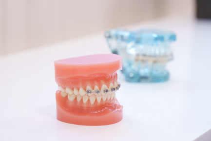 ワイヤー矯正＋マウスピース型矯正装置（クリアアライナー）