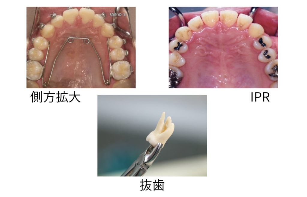 スペースを 確保するための3つの方法