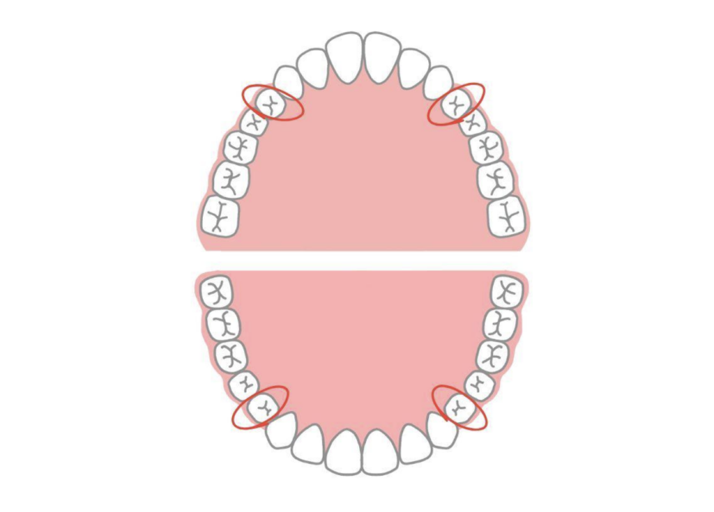 審美的な影響が少ない