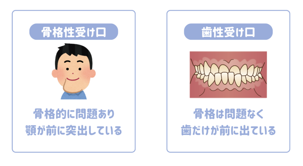 受け口の二つの種類と主な原因
